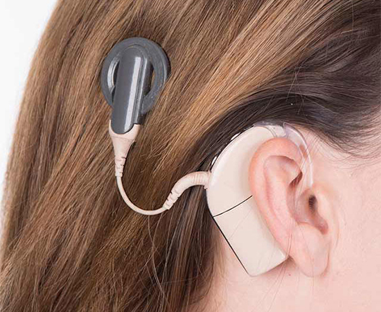 Bionic Ear Surgery